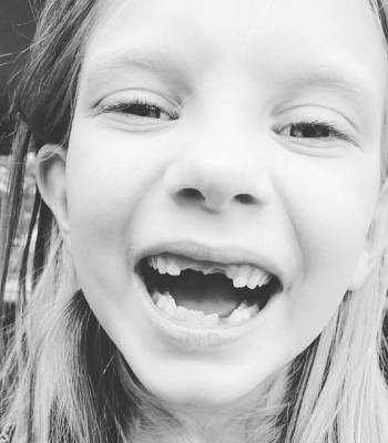 all she'll want for Christmas is her two front teeth back